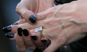 como tratar as varices nos brazos